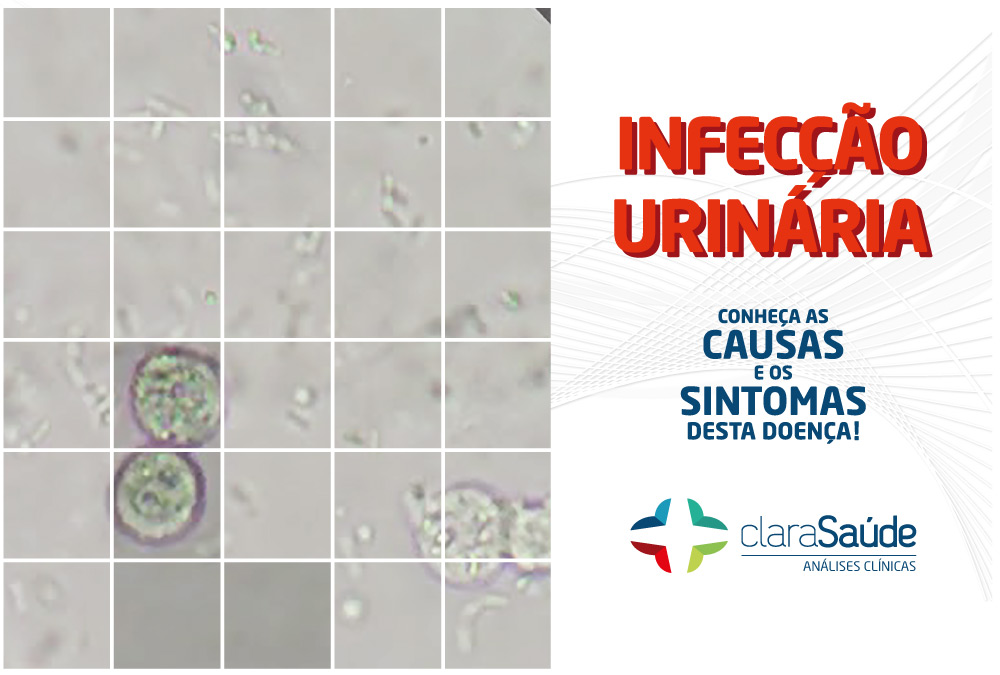 INFECÇÃO URINÁRIA